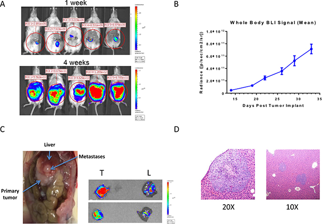 Development of a CRC PDX model of spontaneous metastasis to the liver.