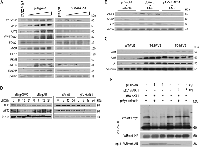 The effects of AR overexpression or knockdown on AKT/mTOR signaling.