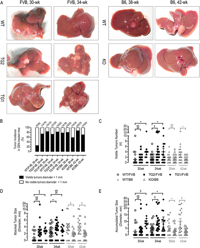 DEN-induced HCC in liver-specific AR overexpressing transgenics and Ar knockout mice.