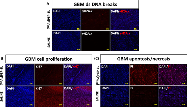 [225Ac]Pep-1L causes double strand DNA breaks, GBM cytotoxicity and reduces cell proliferation in orthotopic U251 GBMs.