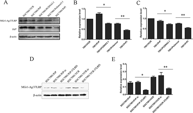 The protein expression of MGr1-Ag/37LRP in PrPC up-regulated and down-regulated gastric cancer cells.