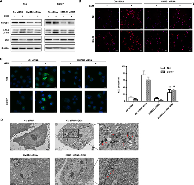 HMGB1 knockdown attenuates GEM-induced autophagy in bladder cancer cells.