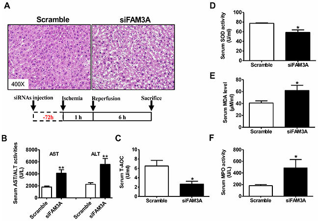 Knockdown of FAM3A exaggerated liver IRI in mouse.