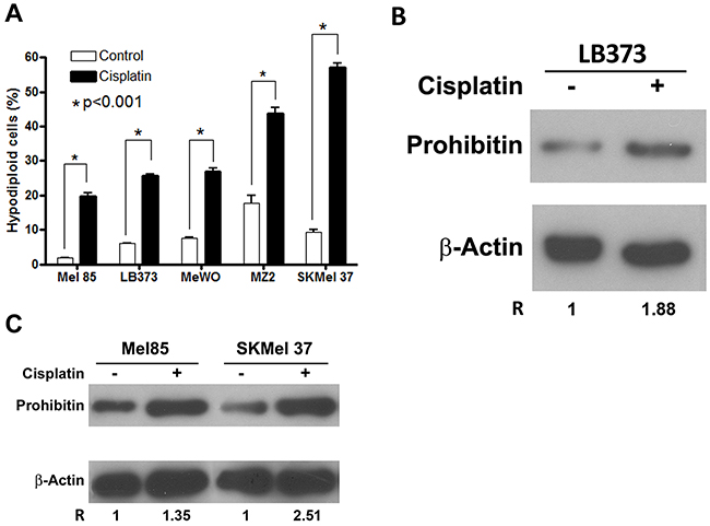 Cisplatin induces prohibitin accumulation and cell death in different melanoma cells.