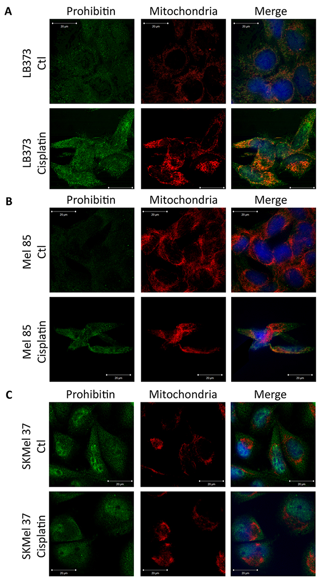 Differential subcellular localization of prohibitin in melanoma cell lines.