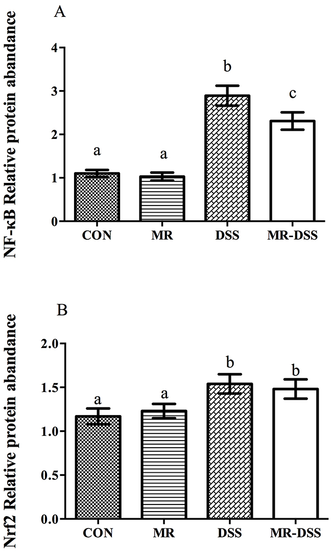 NF-&#x03BA;B (A) and Nrf2/Keap1 (B) signaling pathways in the DSS-induced colitis model.