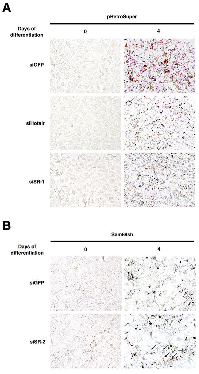 Sam68-regulated lncRNAs are required for lipid accumulation.