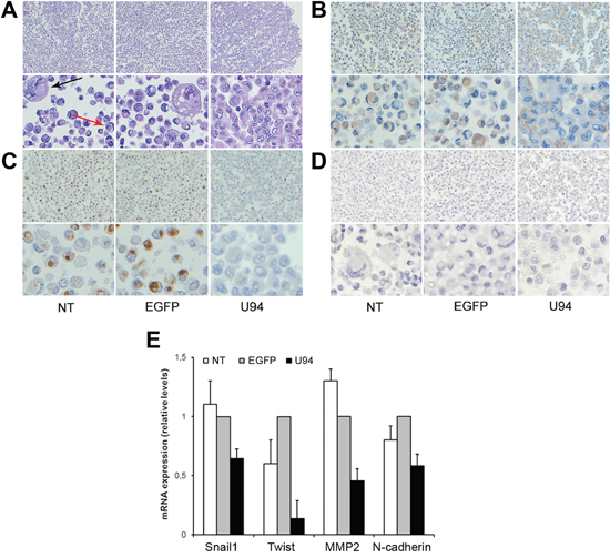 U94 expression induces a partial MET in MDA-MB 231 cells.