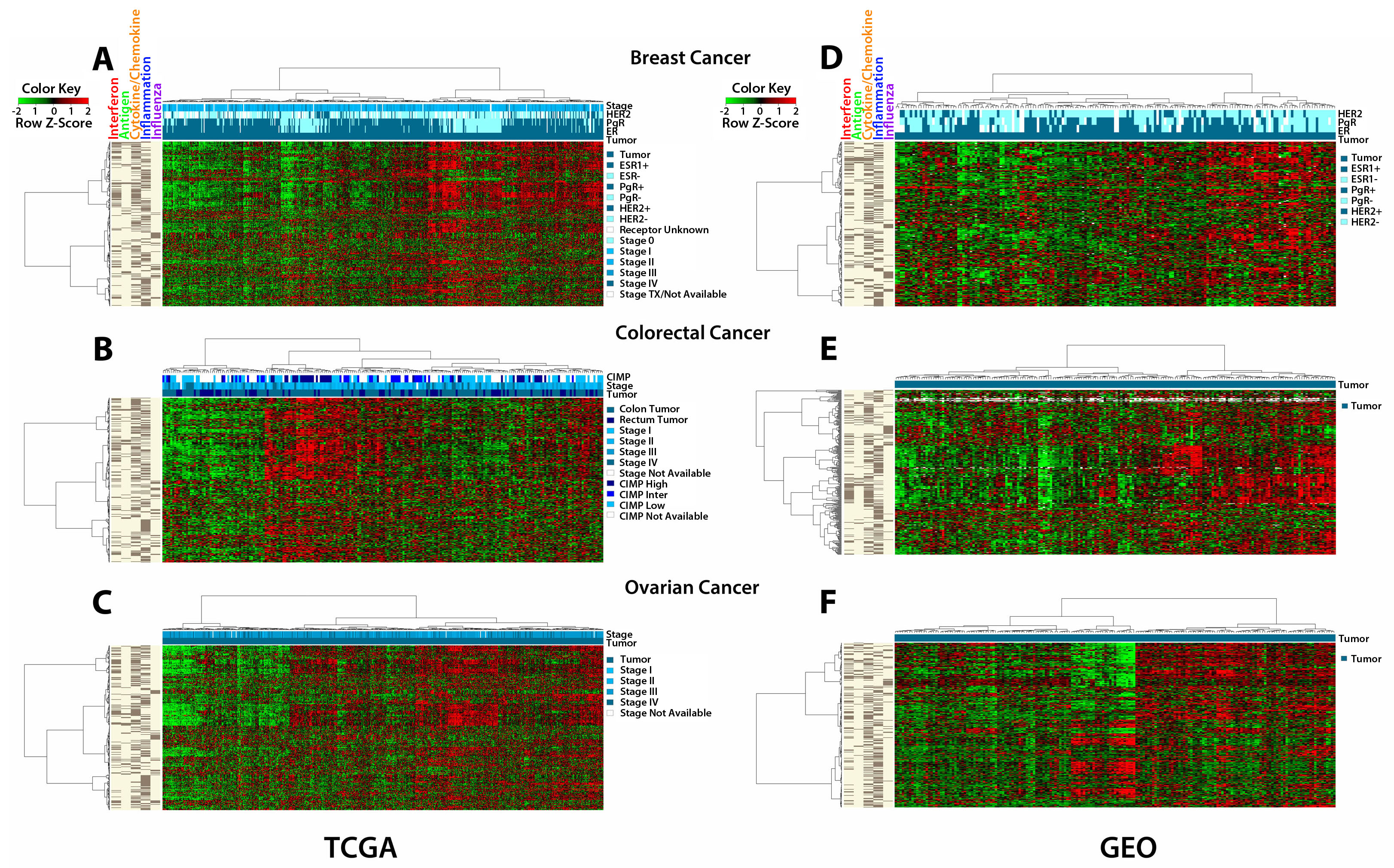 The AIM 317 gene panel clusters TCGA and GEO tumors into high and low immune signatures.