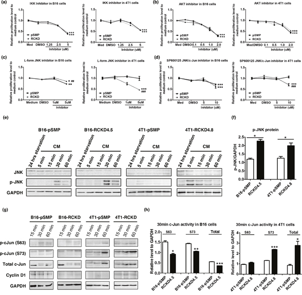 IL-17RC silencing results in acquired-JNK activation but distinct c-Jun activities in B16 and 4T1 cells.