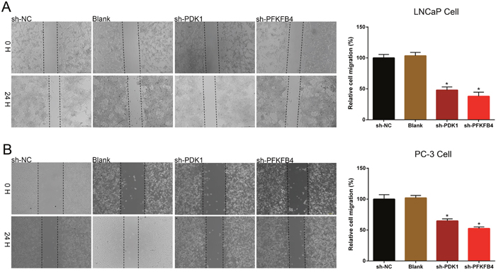 Down-regulation of PDK1 and PFKFB4 inhibited cell migration in LNCaP cells and PC-3 cells.