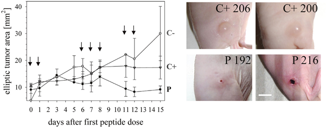 Tumor growth in melanoma xenografts treated or non-treated with peptide R-DIM-P-LF11-334.