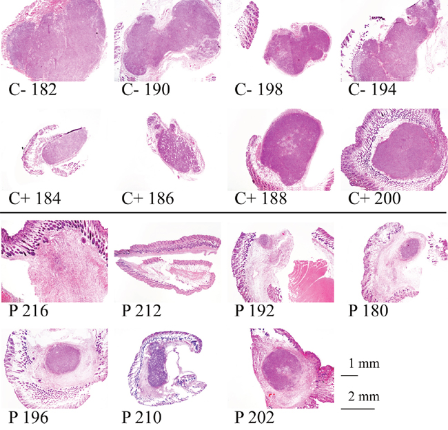 Histological staining of tumors of melanoma xenografts treated or non-treated with peptide R-DIM-P-LF11-334.