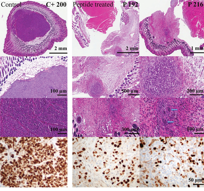 Cell proliferation of tumors of melanoma xenografts treated or non-treated with peptide R-DIM-P-LF11-334.