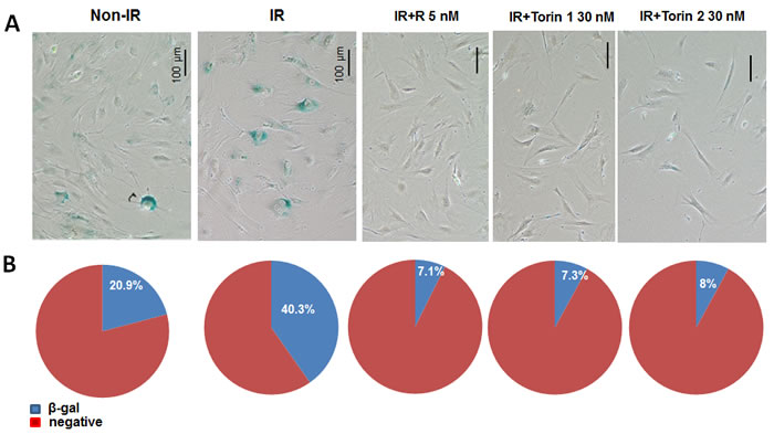 mTOR inhibitors suppress senescent morphology in UVA-irradiated primary adult mouse skin fibroblasts.