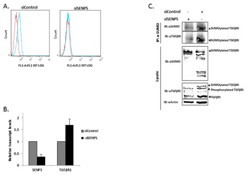 SENP5 tumorigenic effect in breast cancer induces TGF&#x3b2;RI post translation modification.