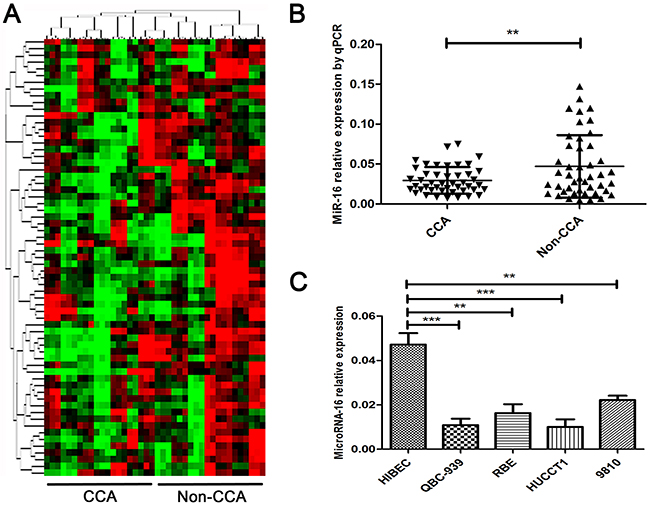 MiR-16 is pronouncedly down-regulated in human CCA tissues and cell lines.