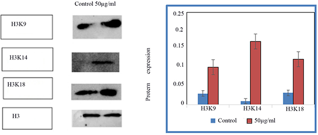 The expression of acH3K9, acH3K14, acH3K18 in control group and HSCs-T6 cells treated with 50ug/ml of blueberry anthocyanin for 36h.