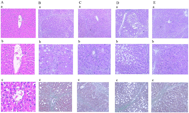 Comparison of HE and Masson staining in liver of rats in each group.