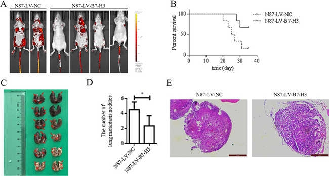 B7-H3 silencing reduced N87 cell lung metastasis in nude mice (n = 6 per group).