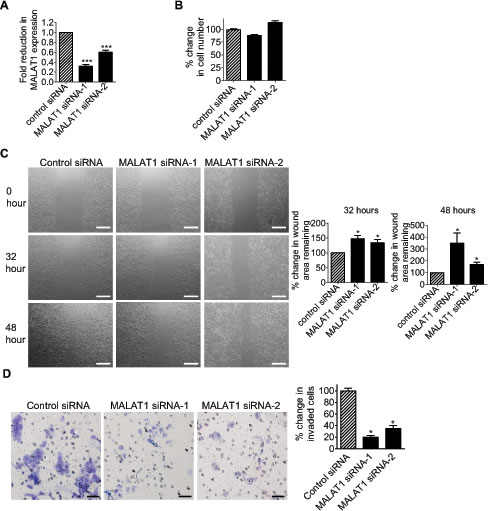 MALAT1 induces neuroblastoma cell migration and invasion.