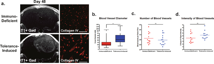 Immune tolerant mice have increased blood-brain-barrier permeability and differences in vascular features.