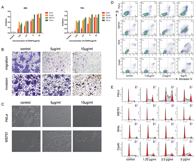 CONPs induce apoptosis and inhibit the migration of cervical carcinoma.