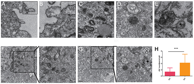 Transmission electron microscope images of MS751 cells treated with CONPs.