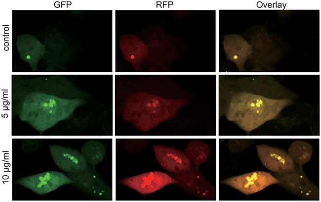 Autophagy flux of the MS751 cells treated with various concentration of CONPs for 72h.