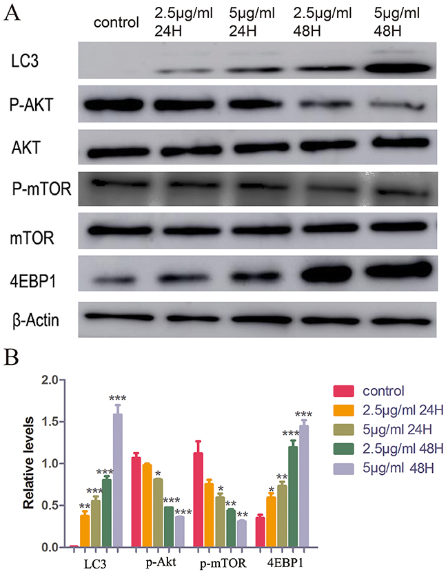 Western blot assay of LC3, AKT, p-AKT, mTOR, p-mTOR, 4EBP1 and &#x03B2;-actin.