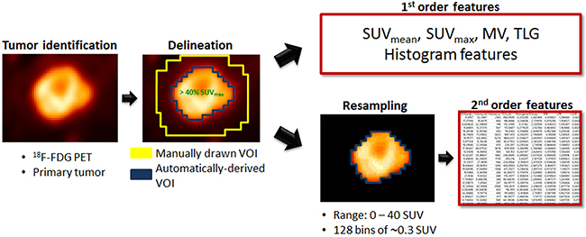 Radiomic feature extraction pipeline.