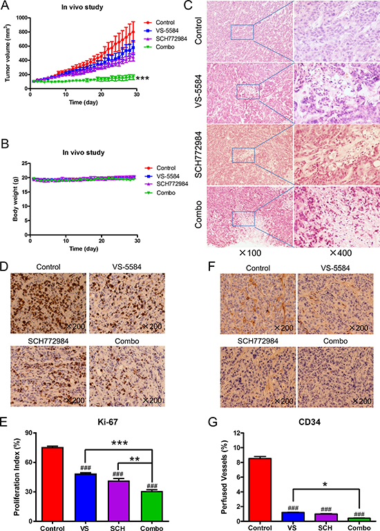 SCH772984 enhances the antitumor activity of VS-5584 in an HPAC xenograft mouse model.