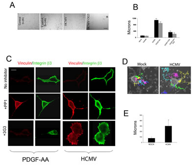 HCMV promotes glioma cell motility and enhances primary glioma stem cell migration.