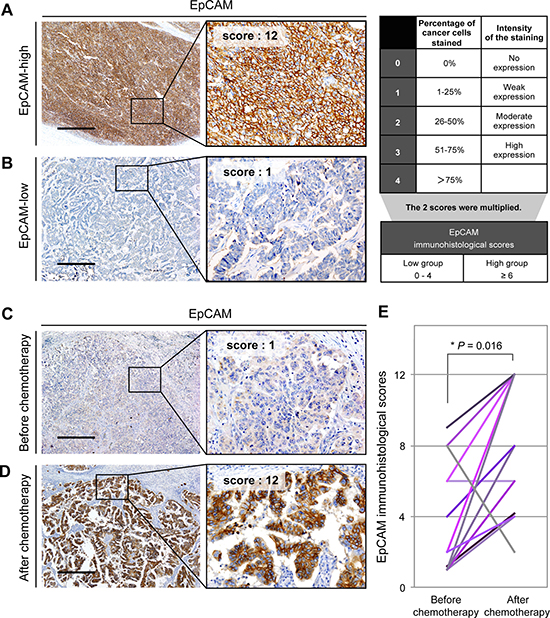 EpCAM expression is increased in ovarian cancer tissues obtained after platinum-based chemotherapy.