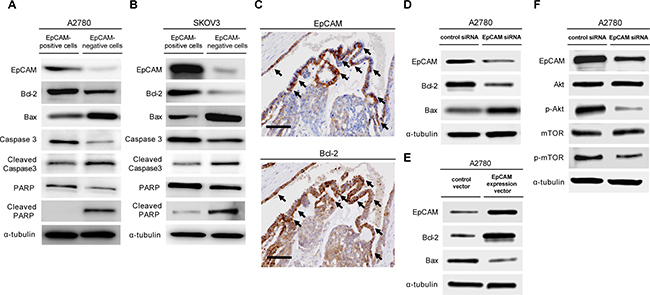 The subpopulation of EpCAM-positive ovarian cancer cells prevents platinum anticancer drug-induced apoptosis.