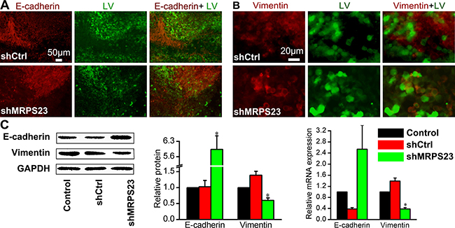 In vivo treatment of shMRPS23 represses breast cancer metastasis by a reversal of EMT.