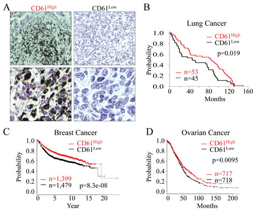 CD61 status predicts the overall survival of the cancer patients.