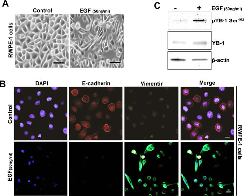 YB-1 Phosphorylation is increased in an endogenous EGF model of EMT.