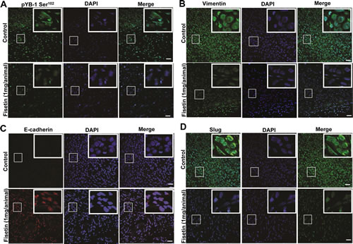 Fisetin treatment inhibits YB-1 phosphorylation and EMT in vivo.