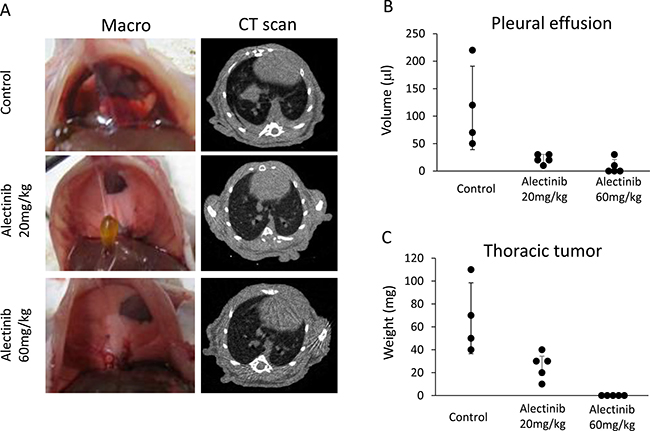 Alectinib inhibits the production of intrathoracic lesions and pleural effusions by tumor cells with NCOA4-RET.