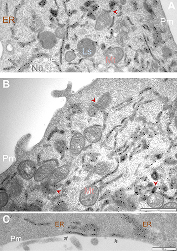 APEX2-enhanced gold particle EM detects Sig1R localization in the ER network and at the ER/mitochondria contacts.