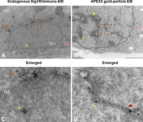 Both immuno-EM and antibody-free APEX2-enhanced gold-particle EM visualize Sig1R localization inside the nucleus.