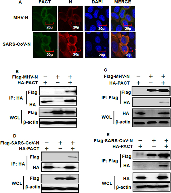 PACT interacts with the N proteins of MHV and SARS-CoV.