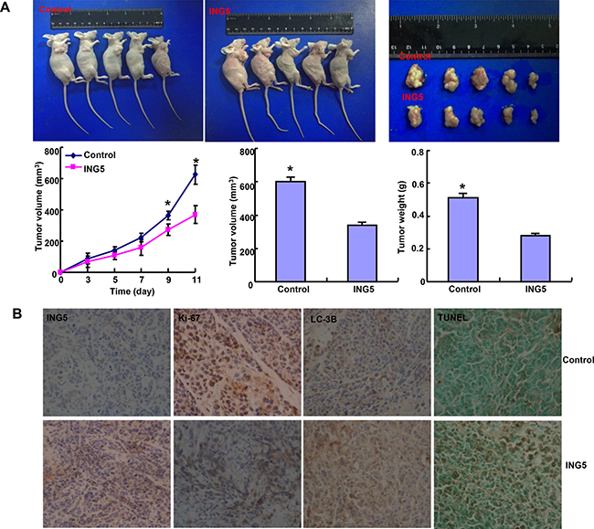 The effects of ING5 overexpression on the tumor growth of breast cancer cells in nude mice.