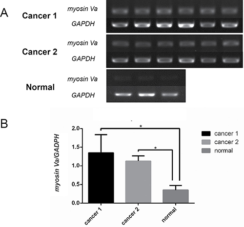 Characterization of myosin Va mRNA expression in prostate cancer.