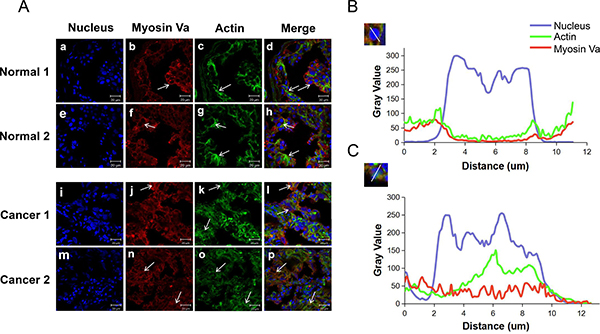 Immunofluorescent localization of myosin Va and actin in normal testis and testicular tumors.