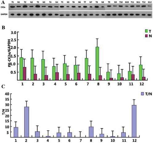 CK2&#x03B1; expression in 12 selected tumor samples.