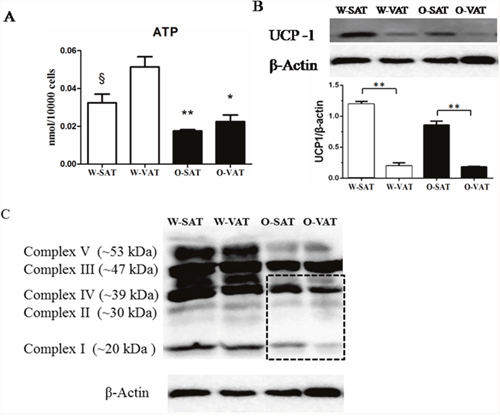 Mitochondrial function in different depots from WT and ob/ob mice.