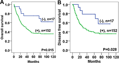 Kaplan-Meier analyses of overall survival and disease free survival curves for Twist1 expression in esophageal squamous cell carcinoma stromal tissues patients.