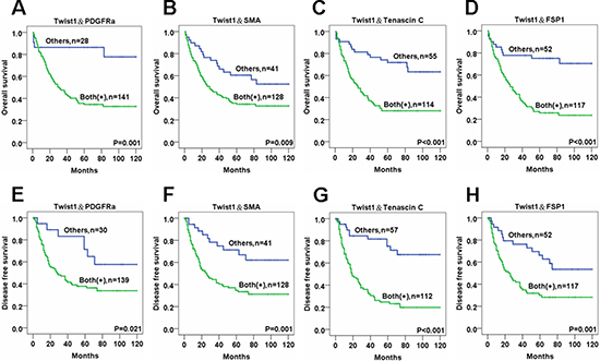 The survival analysis of esophageal cancer patients for the expressions of Twist1 and various CAF markers in cancer stromal fibroblasts.